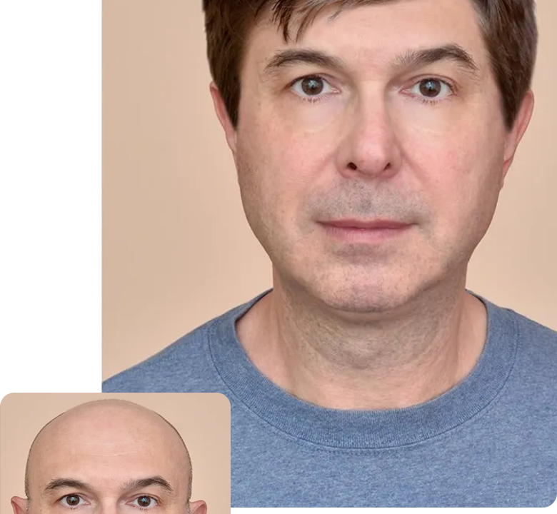 Advanced Hair Restoration