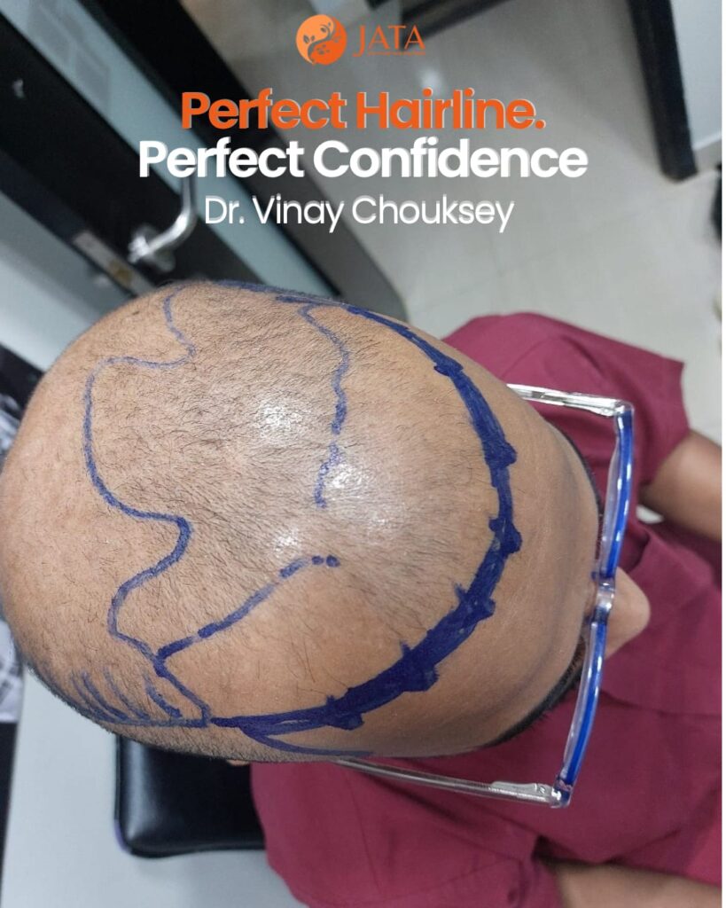 perfect-hairline